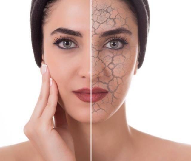 Pelle secca in inverno? ecco come trattarla