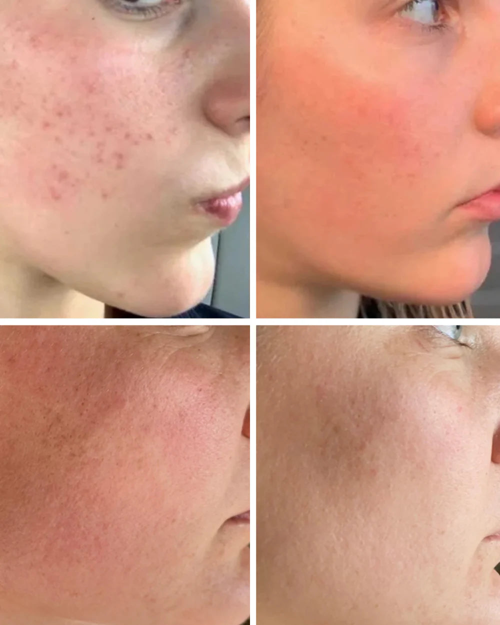 Bakuchiol Siero Pro-Age 30ML 97% Ingredienti Naturali Made in Italy